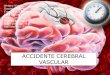 Acidente Vascular Cerebral UPE - Universidade Privada Del este