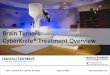 Brain Tumors: Louisville CyberKnife Treatment Overview