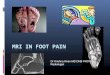 MRI IN FOOT PAIN