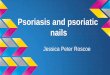 Psoriasis and psoriatic nails