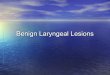 Benign laryngeal lesions presentation