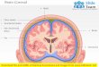 Brain coronal medical images for power point