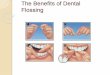 The benefits of dental flossing