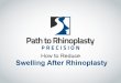 Rhinoplasty Recovery Process