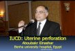 IUCD: Uterine perforation