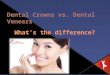 Dental Crowns vs. Dental Veneers What’s the Real difference?