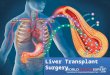 Liver transplant surgery and Procedure
