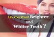 Quick Home Teeth Whitening Tricks Naturally