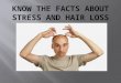 Hair Loss  Treatment in Women