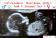 Ultrasound  Machines India China And A Skewed Sex Ratio (Rast Studimor nga Iva Mana)