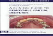 A clinical guide to removable partial dentures