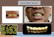 Real gold and silver teeth