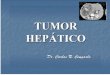 Tumor hepatico jurp
