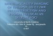 Epilepsy Presentation 3D CT MR Merge for Surgical GuidanceNEWEDIT