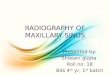Radiography of maxillary sinus