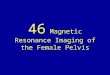 46 magnetic resonance imaging of the female pelvis