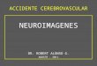 Neuroimagenes en Accidente Cerebrovascular
