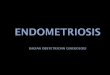 Endometriosis Ppt Fix