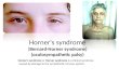 Horner's Syndrome Final
