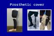 Prosthetic cover