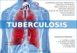 Tuberculosis en Pediatria