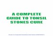 A Complete Guide to Tonsil Stones Cure