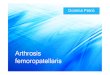 Arthrosis Femoropatellaris