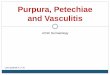 Petechia Purpura Vasculitis