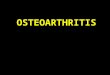 Osteoarthritis 2013