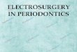 Electrosurgery in Periodontics