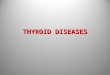 THYROID DISEASES.ppt