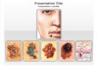 Skin Cancer Treatment Powerpoint Template