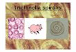 Trichinella spiralis.pdf