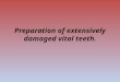 Preparation of Extensively Damaged Vital Teeth