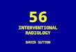 56 DAVID SUTTON PICTURES INTERVENTIONAL NEURORADIOLOGY