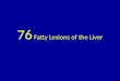 76 fatty lesions of the liver