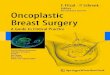 Oncoplastic breast surgery__a_guide_to_clinical_practice