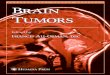 Brain tumors ccr