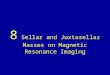 8 sellar and juxtasellar masses on magnetic resonance