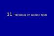 11 thickening of gastric folds