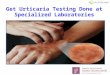 Get Urticaria Testing Done at Specialized Laboratories in India