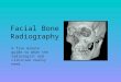 Facial Bone Radiography A five minute guide to what the radiologist and clinician really need