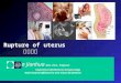 Rupture of uterus 子宫破裂 Lin Jianhua M.D., Ph.D., Professor Department Of Obstetrics & Gynecology Renji Hospital Affiliated to SJTU School of Medicine