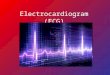 Electrocardiogram (ECG). What is an ECG? ECG: a graphical representation of the electrical activity of the heart. Each movement of electricity through