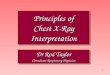 1 Principles of Chest X-Ray Interpretation Dr Rod Taylor Consultant Respiratory Physician Dr Rod Taylor Consultant Respiratory Physician