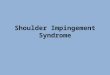 Shoulder Impingement Syndrome. Painful Arc Syndrome Supraspinatus Syndrome Swimmer's Shoulder Thrower's Shoulder