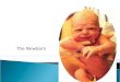 The Newborn. Leifer, G. (2011) Introduction to maternity and pediatric nursing. (6 th edition. Philadelphia: Saunders. Ministry of Health Tamariki Ora