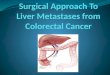 The latest changes in surgery of liver metastatic colorectal cancer. Preoperative evaluation of the patient with hepatic metastases Treatment of liver