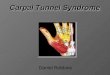 Carpal Tunnel Syndrome Daniel Robbins. What… is it? Carpal tunnel syndrome is a nerve compression syndrome where the median nerve gets compressed at the