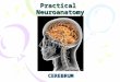 Practical Neuroanatomy CEREBRUM. External features of the cerebrum Surfaces: - Superolateral - Medial - Inferior ( orbital & tentorial ) Borders: -